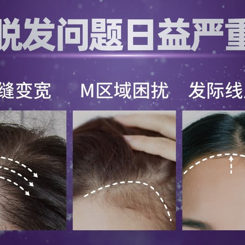 克洛特 头皮益护防脱洗发水套装400mL*3瓶 详情图 2